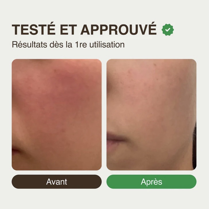 Duo visage réconfortant peaux sensibles Noix AOP de Grenoble – Image 3